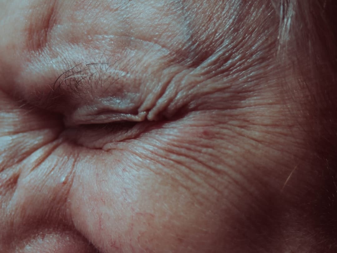 Photo Skin texture