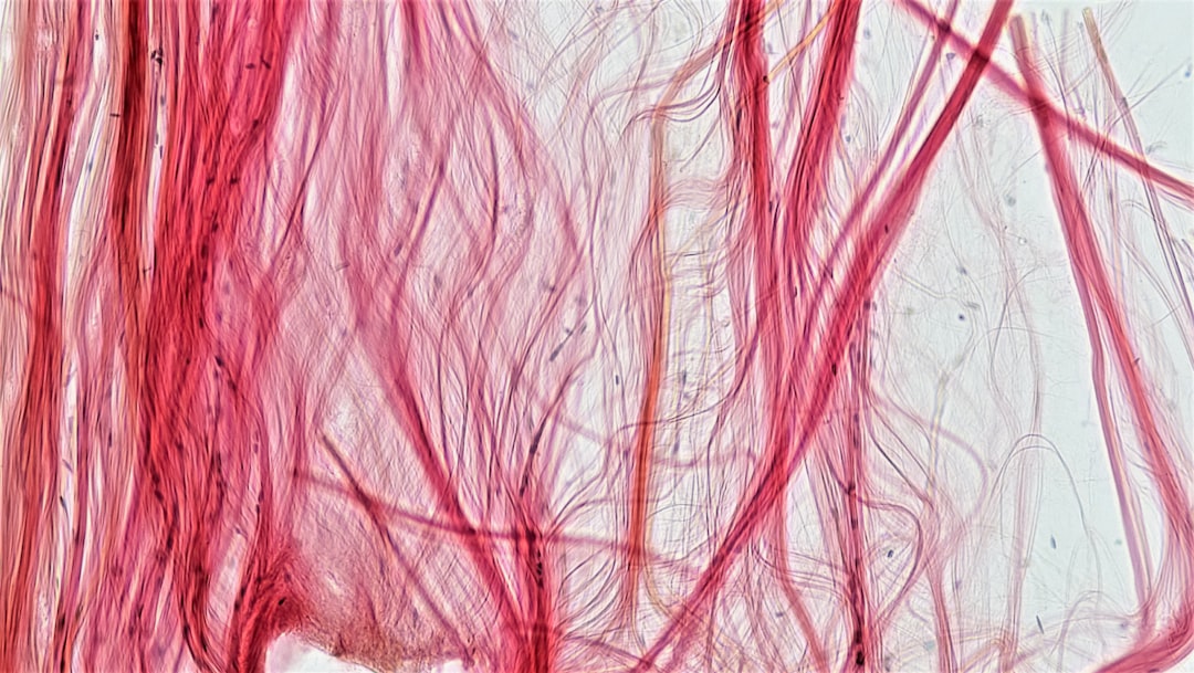 Photo Tendon diagram