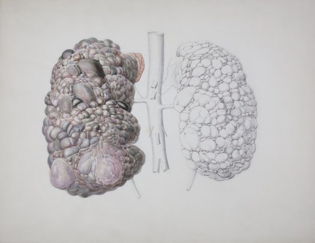 Photo Kidney diagram