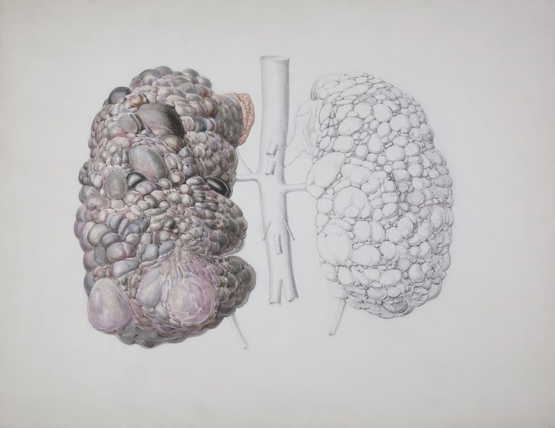Photo Kidney diagram
