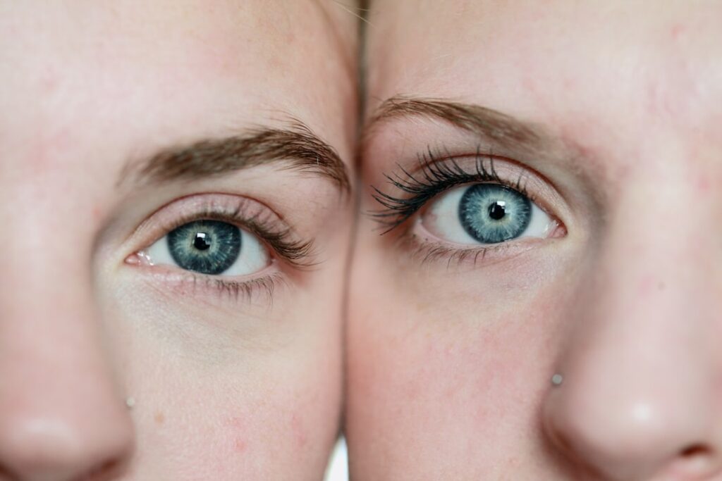 Photo Youthful skin