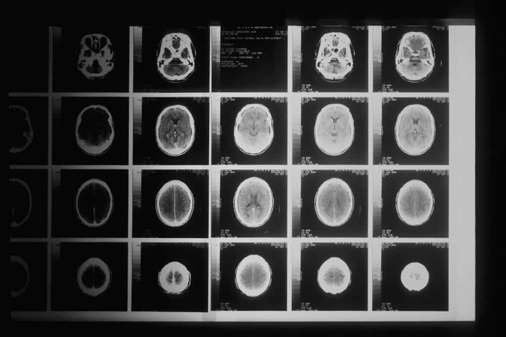 Photo Brain cells