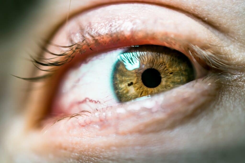 Photo Skin cells